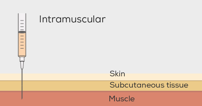 Intramuscular injections go past the skin and subcutaneous tissue into the muscle