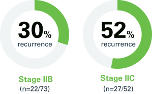 30% Stage IIB (n=22/73), 52% Stage IIC (n=27/52)