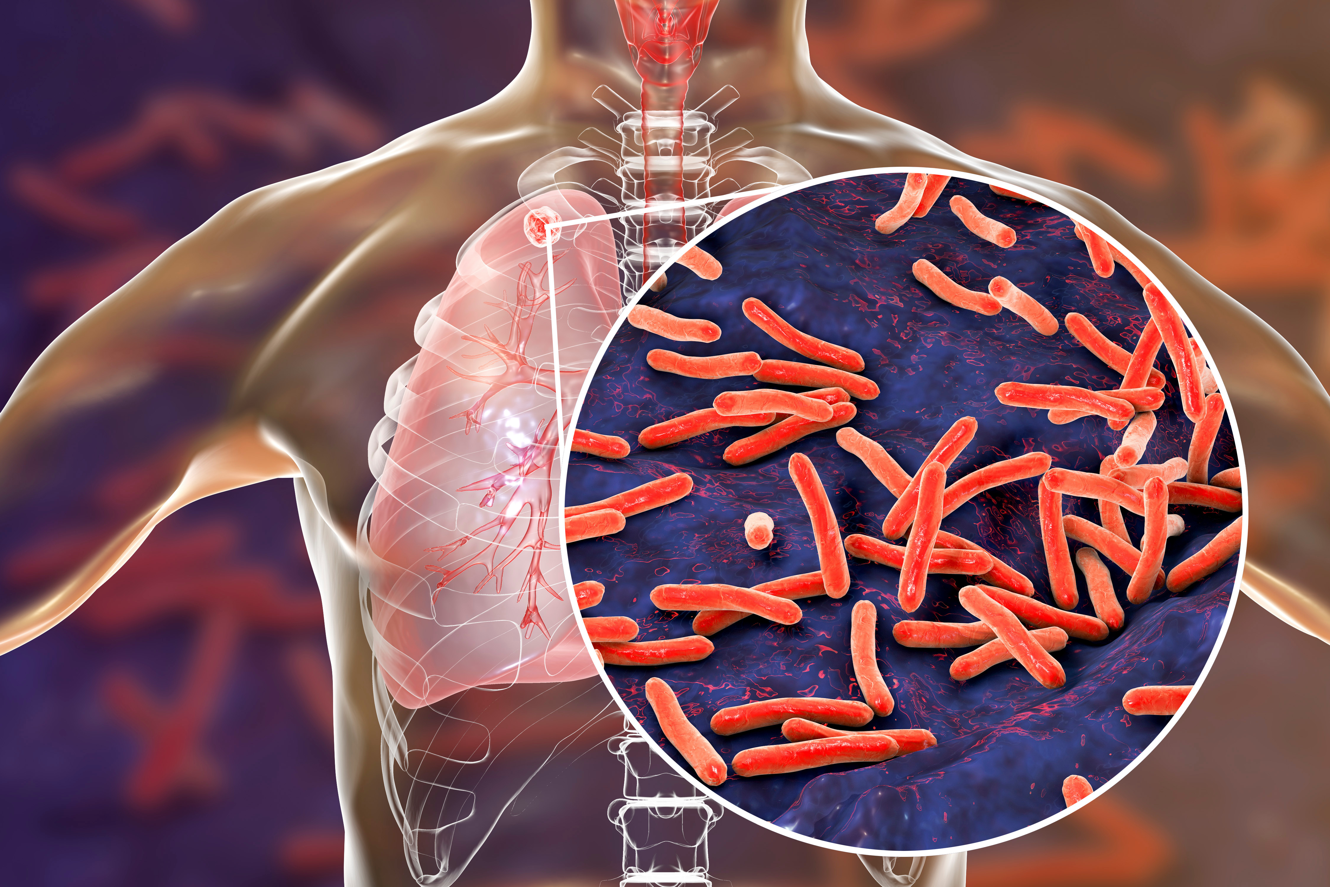 lung bacteria